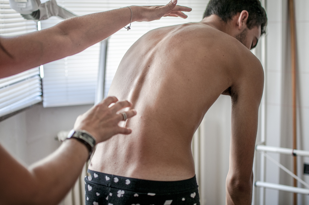 doctor performs a medical examination on a patient diagnosed with scoliosis