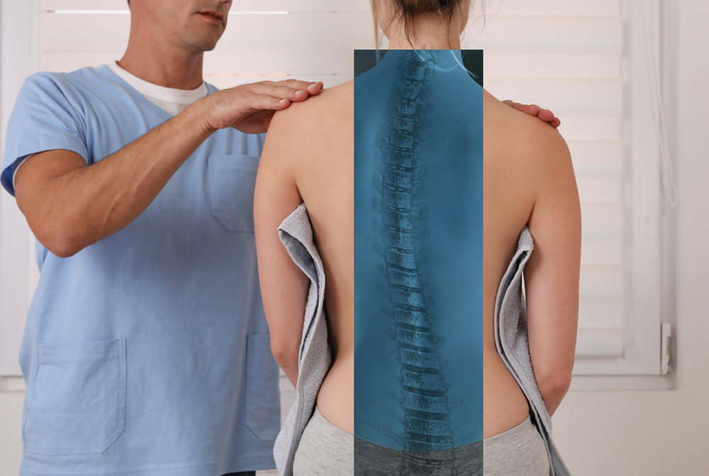 Doctor evaluating woman with scoliosis.